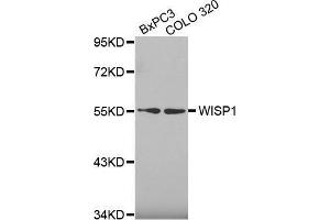 Western blot analysis of extracts of various cell lines, using WISP1 antibody. (WISP1 Antikörper  (AA 158-367))
