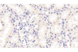 Detection of SOX18 in Rat Kidney Tissue using Polyclonal Antibody to Sex Determining Region Y Box Protein 18 (SOX18)