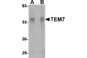 Western blot analysis of TEM7 in rat liver tissue lysate with this product at (A) 0. (PLXDC1 Antikörper  (Center))