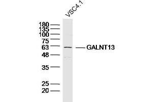 VSC4. (GALNT13 Antikörper  (AA 351-450))