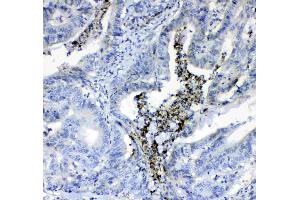 IHC analysis of Prothrombin  using anti-Prothrombin  antibody . (Prothrombin Antikörper  (AA 67-124))