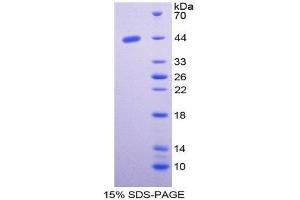 SDS-PAGE (SDS) image for Nischarin (NISCH) (AA 1246-1346) protein (His tag,GST tag) (ABIN2123398)