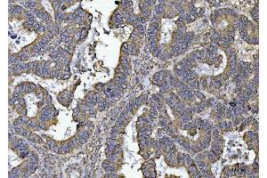 IHC analysis of ATP5F1B using anti-ATP5F1B antibody (ABIN7599866). (Atp5f1b (AA 123-529) Antikörper)