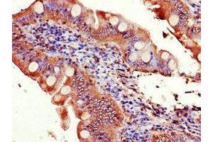 Immunohistochemistry of paraffin-embedded human small intestine tissue using ABIN7152149 at dilution of 1:100 (EIF3C Antikörper  (AA 201-500))