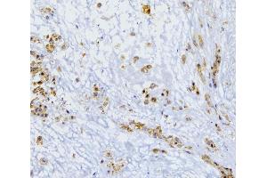 IHC analysis of SQSTM1 using anti-SQSTM1 antibody (ABIN3043937). (SQSTM1 Antikörper  (N-Term))