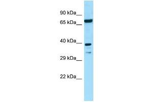 WB Suggested Anti-EIF2B2 Antibody Titration: 1. (EIF2B2 Antikörper  (N-Term))
