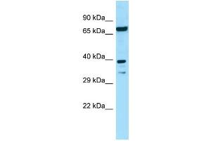 Western Blotting (WB) image for anti-Eukaryotic Translation Initiation Factor 2B, Subunit 2 Beta, 39kDa (EIF2B2) (N-Term) antibody (ABIN2790210)