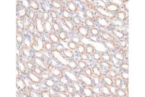Immunohistochemistry of paraffin-embedded Mouse kidney using PDGFD Polyclonal Antibody at dilution of 1:100 (40x lens). (PDGFD Antikörper)