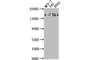 Western Blot Positive WB detected in: MCF-7 whole cell lysate, U87 whole cell lysate, K562 whole cell lysate All lanes: TJP2 antibody at 1:2000 Secondary Goat polyclonal to rabbit IgG at 1/50000 dilution Predicted band size: 134, 118, 112, 132, 116, 131, 138 kDa Observed band size: 150 kDa (TJP2 Antikörper  (AA 1165-1183))