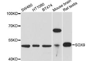 Western blot analysis of extracts of various cell lines, using SOX9 antibody. (SOX9 Antikörper)