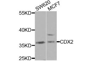 Western blot analysis of extracts of various cell lines, using CDX2 antibody. (CDX2 Antikörper)