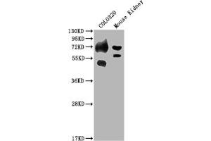 Western Blot Positive WB detected in: COLO320 whole cell lysate, Mouse Kidney tissue All lanes: SLC39A4 antibody at 1:2000 Secondary Goat polyclonal to rabbit IgG at 1/50000 dilution Predicted band size: 69, 67 kDa Observed band size: 69 kDa (SLC39A4 Antikörper  (AA 26-266))