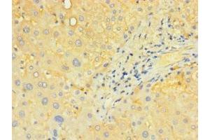 Immunohistochemistry (IHC) image for anti-Solute Carrier Family 25 (Mitochondrial Carrier, Adenine Nucleotide Translocator), Member 4 (SLC25A4) (AA 40-102) antibody (ABIN7170195)