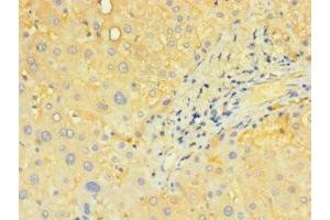 Immunohistochemistry of paraffin-embedded human liver tissue using ABIN7170195 at dilution of 1:100 (SLC25A4 Antikörper  (AA 40-102))