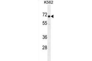 Western Blotting (WB) image for anti-Insulin-Like Growth Factor 2 mRNA Binding Protein 1 (IGF2BP1) antibody (ABIN2995660) (IGF2BP1 Antikörper)