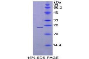 SDS-PAGE analysis of Rat MEPE Protein. (MEPE Protein)