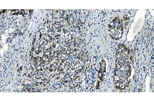 IHC analysis of TMBIM1 using anti-TMBIM1 antibody (ABIN7603190).