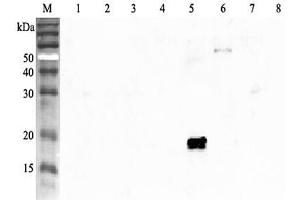 Western blot analysis using anti-ANGPTL4 (human), pAb  at 1:2'000 dilution. (ANGPTL4 Antikörper  (AA 79-101))