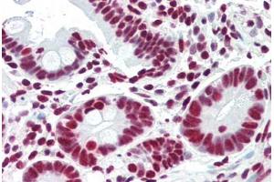 Human Small Intestine (formalin-fixed, paraffin-embedded) stained with ACIN1 antibody ABIN461879 at 5 ug/ml followed by biotinylated goat anti-rabbit IgG secondary antibody ABIN481713, alkaline phosphatase-streptavidin and chromogen. (ACIN1 Antikörper)