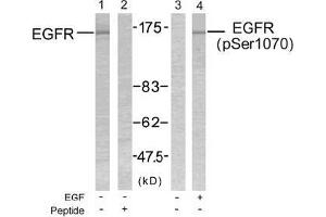 Image no. 2 for anti-Epidermal Growth Factor Receptor (EGFR) (pSer1070) antibody (ABIN196758) (EGFR Antikörper  (pSer1070))