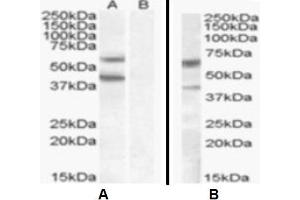 Western Blotting (WB) image for anti-Diacylglycerol O-Acyltransferase 2 (DGAT2) (Internal Region) antibody (ABIN2465597) (DGAT2 Antikörper  (Internal Region))