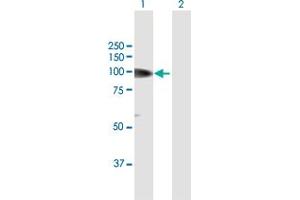Western Blotting (WB) image for anti-Mutated in Colorectal Cancers (MCC) (AA 1-829) antibody (ABIN950122)