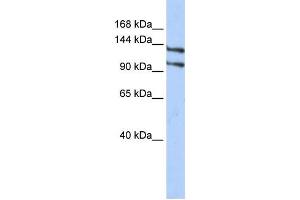 Western Blotting (WB) image for anti-RNA Binding Motif Protein 5 (RBM5) antibody (ABIN2458330) (RBM5 Antikörper)
