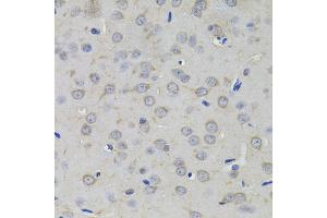 Immunohistochemistry of paraffin-embedded rat brain using AMPD1 antibody (ABIN5995393) (40x lens). (AMPD1 Antikörper)