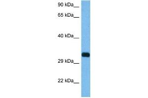 Host:  Mouse  Target Name:  RIMS3  Sample Tissue:  Mouse Pancreas  Antibody Dilution:  1ug/ml (RIMS3 Antikörper  (C-Term))