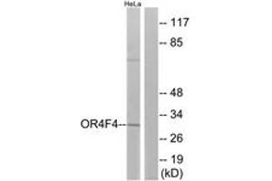 Western Blotting (WB) image for anti-Olfactory Receptor, Family 4, Subfamily F, Member 4 (OR4F4) (AA 256-305) antibody (ABIN2891009) (OR4F4 Antikörper  (AA 256-305))