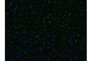 Immunofluorescence staining of an infarcted porcine heart with anti-CD105 (MEM-229 ; (Endoglin Antikörper  (FITC))