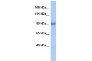 Image no. 1 for anti-Squamous Cell Carcinoma Antigen Recognized By T Cells 3 (SART3) (AA 827-876) antibody (ABIN6742461)