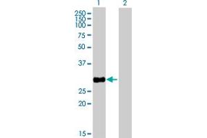 Western Blot analysis of HSD17B8 expression in transfected 293T cell line by HSD17B8 MaxPab polyclonal antibody. (HSD17B8 Antikörper  (AA 1-261))