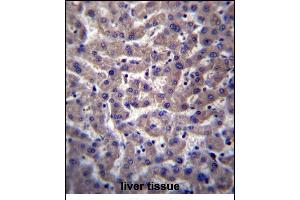 Immunohistochemistry (Paraffin-embedded Sections) (IHC (p)) image for anti-Prostaglandin Reductase 2 (PTGR2) (AA 65-94), (N-Term) antibody (ABIN656796)
