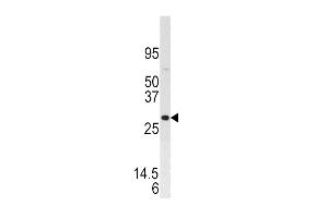 Western blot analysis of anti-DUSP3 Pab (ABIN392924 and ABIN2842297) in SK-BR-3 cell line lysate. (Dual Specificity Phosphatase 3 (DUSP3) (AA 1-30), (N-Term) Antikörper)