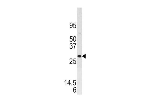Dual Specificity Phosphatase 3 (DUSP3) (AA 1-30), (N-Term) Antikörper