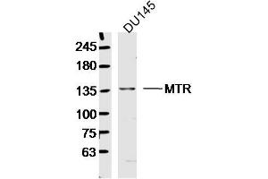 DU145 lysates probed with MTR Polyclonal Antibody, Unconjugated  at 1:300 dilution and 4˚C overnight incubation. (MTR Antikörper  (AA 1001-1100))