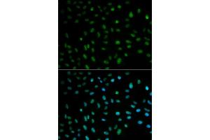 Immunofluorescence analysis of MCF-7 cells using ELAVL1 antibody. (ELAVL1 Antikörper)