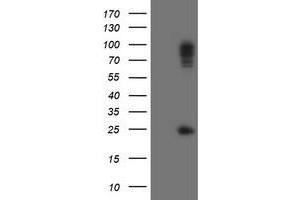 Image no. 1 for anti-Spastic Paraplegia 7 (SPG7) (AA 300-573) antibody (ABIN1491370) (SPG7 Antikörper  (AA 300-573))
