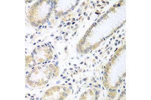 Immunohistochemistry of paraffin-embedded human stomach using IL5 antibody (ABIN5975164) at dilution of 1/100 (40x lens). (IL-5 Antikörper)