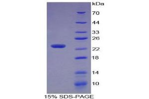SDS-PAGE (SDS) image for Stathmin 1 (STMN1) (AA 2-149) protein (His tag) (ABIN2126854) (Stathmin 1 Protein (STMN1) (AA 2-149) (His tag))
