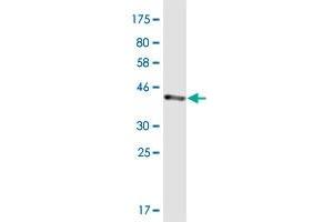 Western Blot detection against Immunogen (40. (GABARAP Antikörper  (AA 1-117))