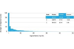 Analysis of Protein Array containing >19,000 full-length human proteins using NKX2.