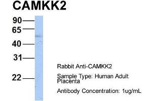 Host: Rabbit  Target Name: CAMKK2  Sample Tissue: Human Adult Placenta  Antibody Dilution: 1. (CAMKK2 Antikörper  (N-Term))