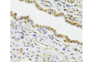 Immunohistochemistry of paraffin-embedded Rat liver using EFTUD2 Polyclonal Antibody at dilution of 1:100 (40x lens). (EFTUD2 Antikörper)