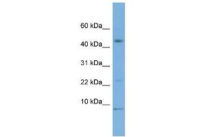 WB Suggested Anti-MIF Antibody Titration: 0. (MIF Antikörper  (Middle Region))