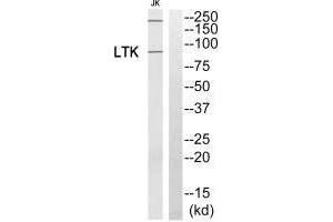 Western blot analysis of extracts from Jurkat cells, using LTK antibody. (LTK Antikörper)