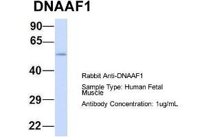 Host: Rabbit  Target Name: DNAAF1  Sample Tissue: Human Fetal Muscle  Antibody Dilution: 1. (LRRC50 Antikörper  (N-Term))
