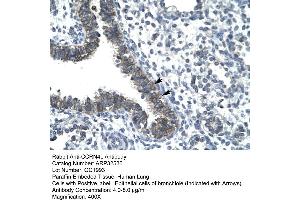 Human Lung (CCRN4L Antikörper  (N-Term))