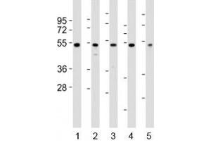 Western blot testing of NFKBIE antibody at 1:2000 dilution. (NFKBIE Antikörper  (N-Term))